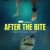 After the Bite (2023) Türkçe Altyazılı izle